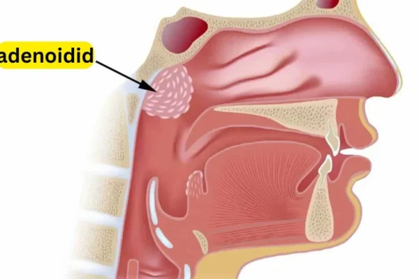 adenoidid