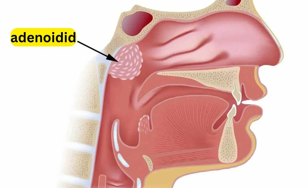 adenoidid
